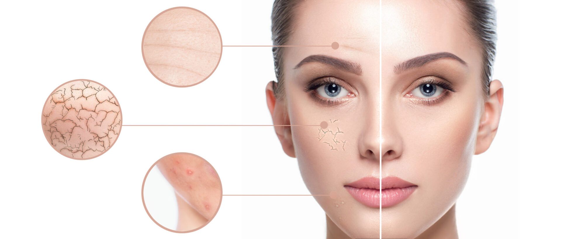Tratamiento de rejuvenecimiento celular con polinucleótidos para párpados y ojeras.
